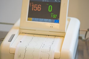 Fetal Heart Monitor