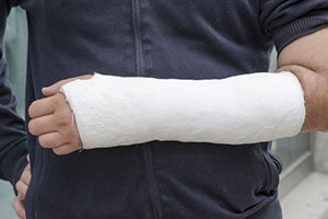 Man with a cast on his hand