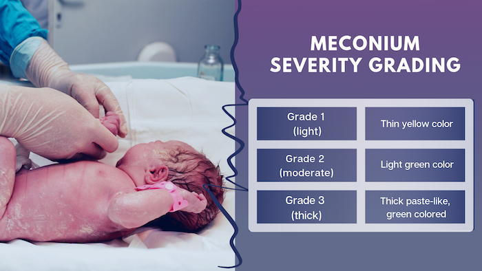 Meconium Severity Grading Infographic